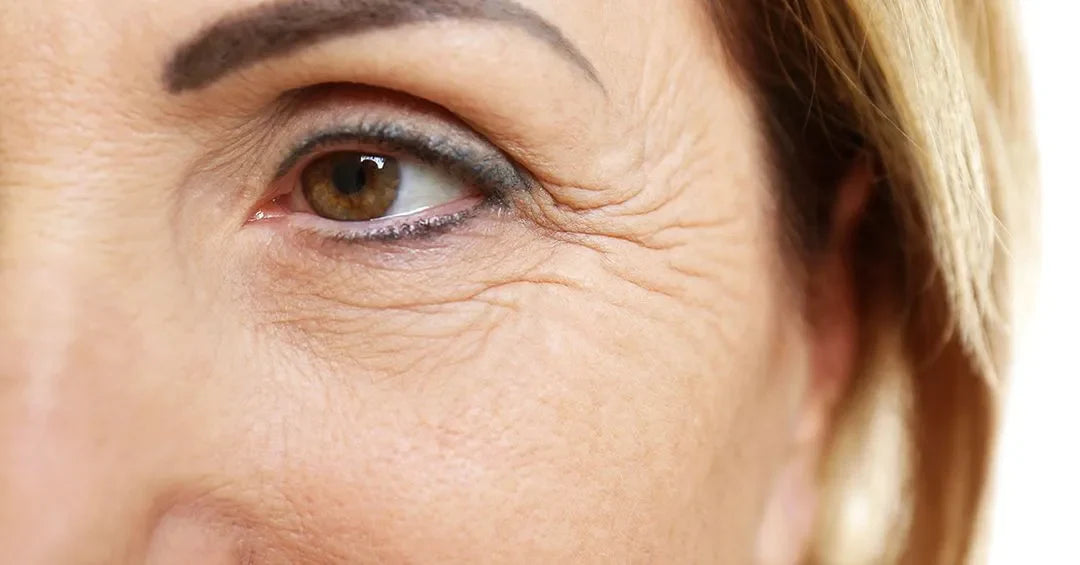 Fine Lines & Wrinkles