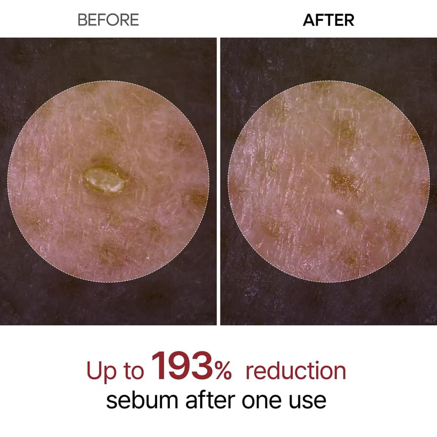 Dr.Melaxin - Peel Shot Exfoliant White Rice Ampoule 8Oml - Gallery 2