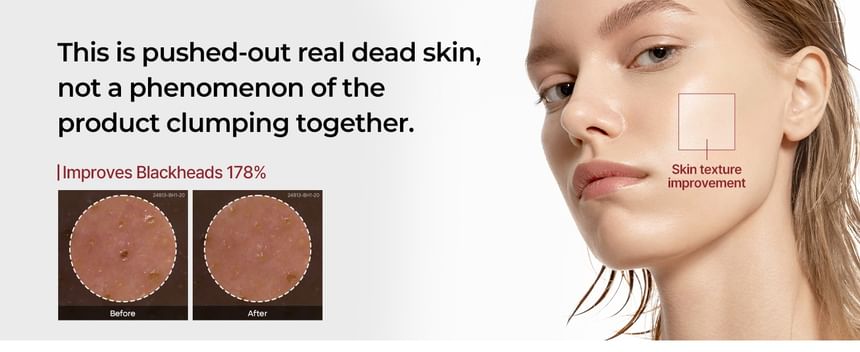 Dr.Melaxin - Peel Shot Exfoliant Black Rice Ampoule 8Oml - Gallery 3