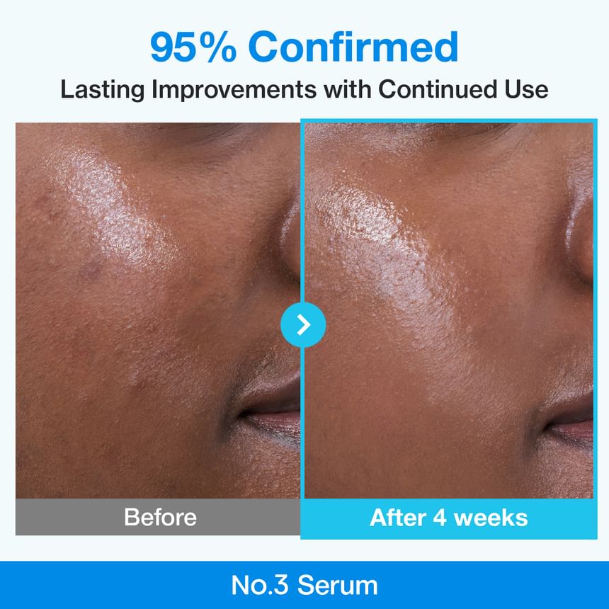 numbuzin - No.3 Blue Bio-Retinol Pore Refining Serum - Gallery 3