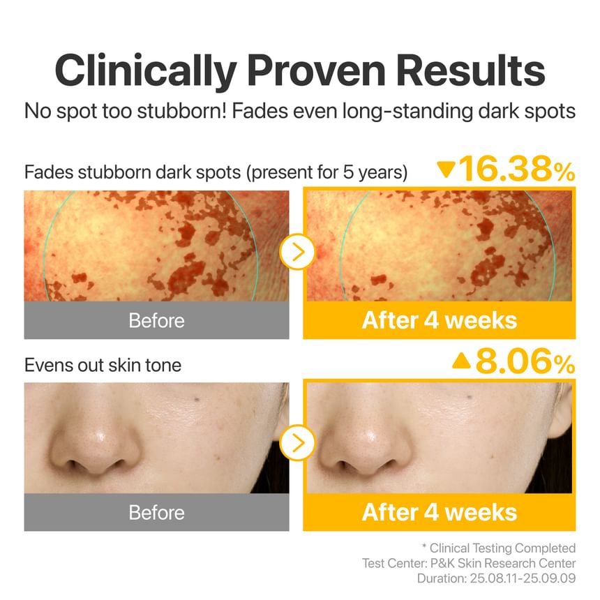 numbuzin - No.5 Glutathione TXA Advanced Dark Spot Ampoule Concentrate - Gallery 4