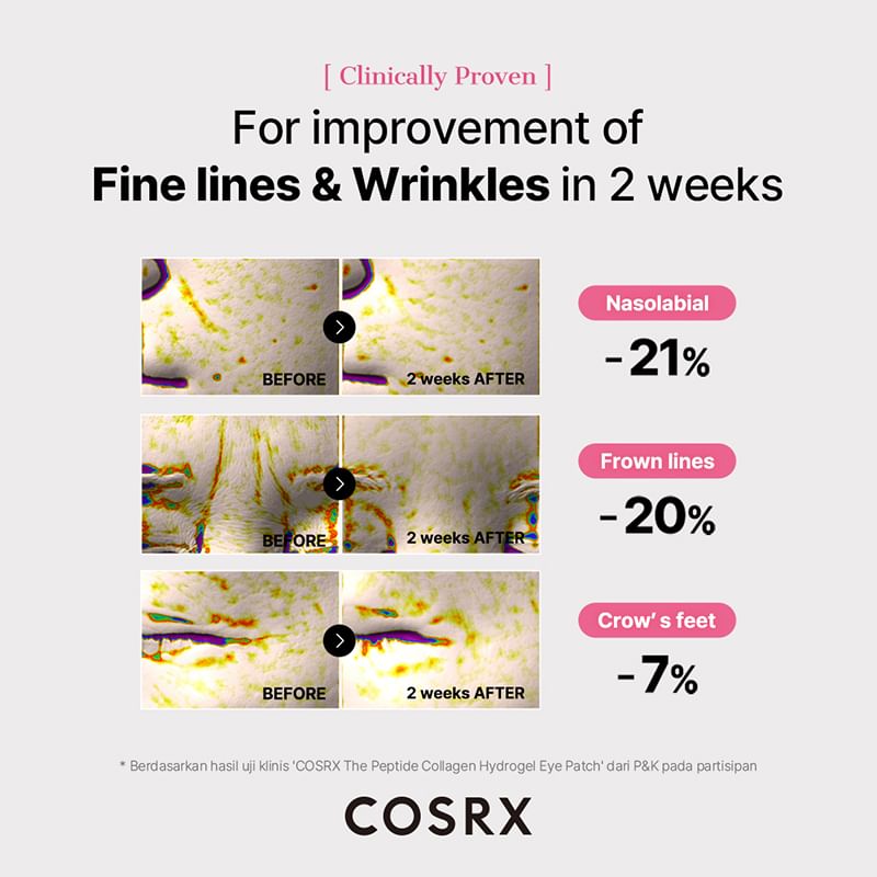 COSRX - The Peptide Collagen Hydrogel Eye Patch - Gallery 4