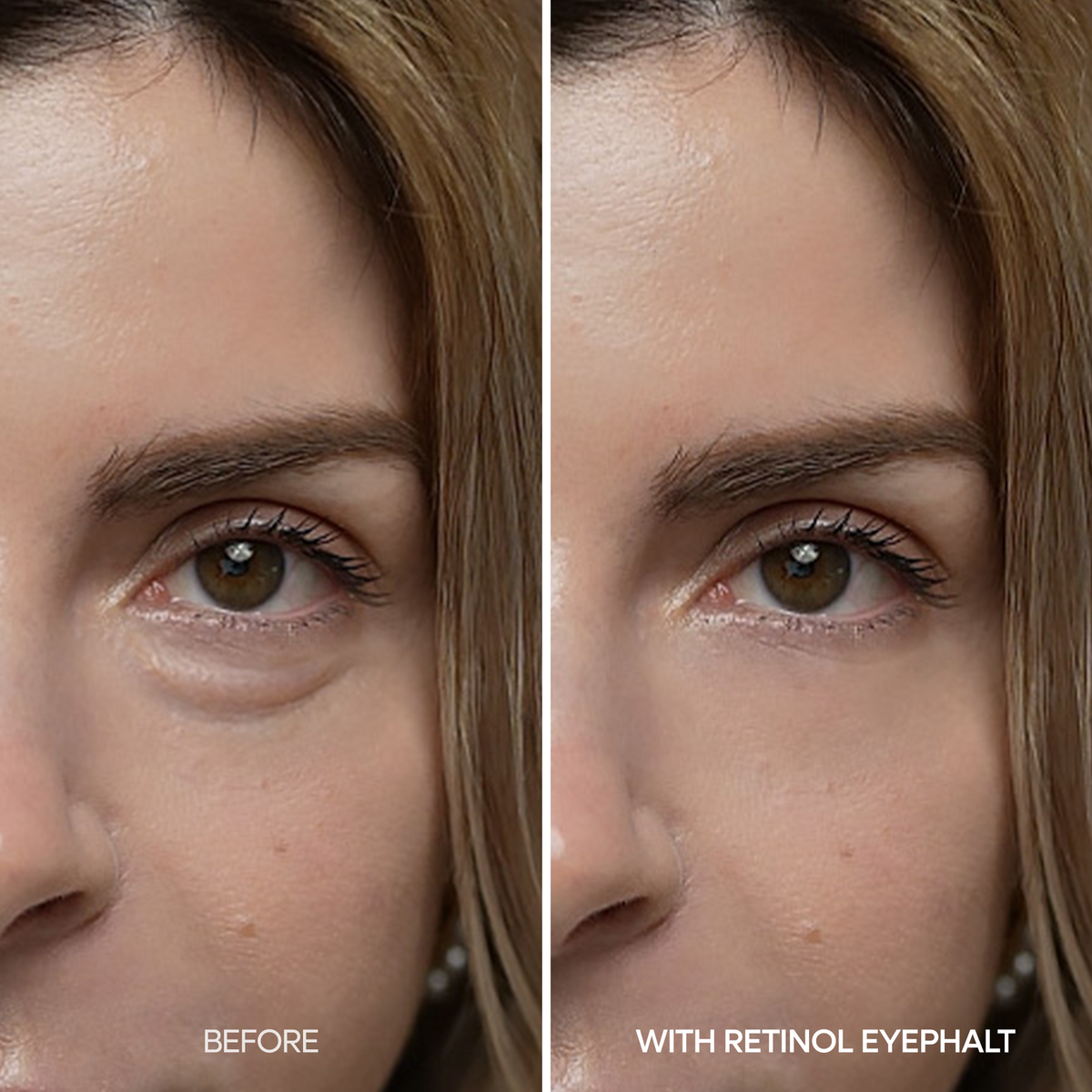 Dr.Melaxin - Retinol Eyebag Cream - Gallery 5
