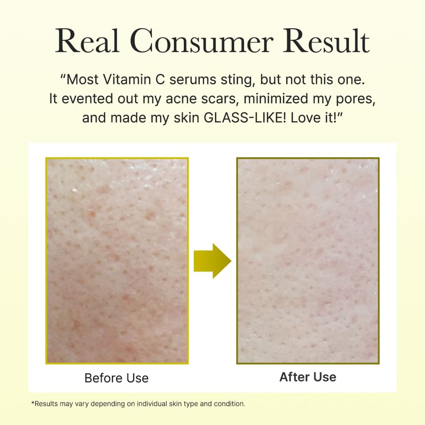 ARENCIA - Vitamin C Booster Shot - Gallery 6