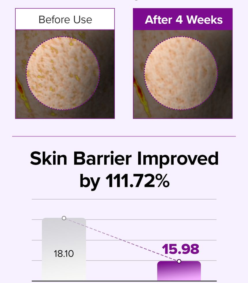 Mary&May - Spicule Collagen PDRN Cream 15g - Gallery 10