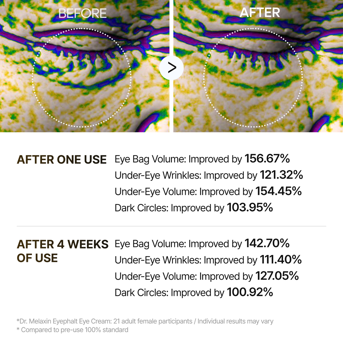 Dr.Melaxin - Retinol Eyebag Cream - Gallery 10