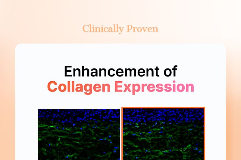 COSRX - 5 PDRN Collagen Intense Vitalizing Serum 100ml - Gallery 11