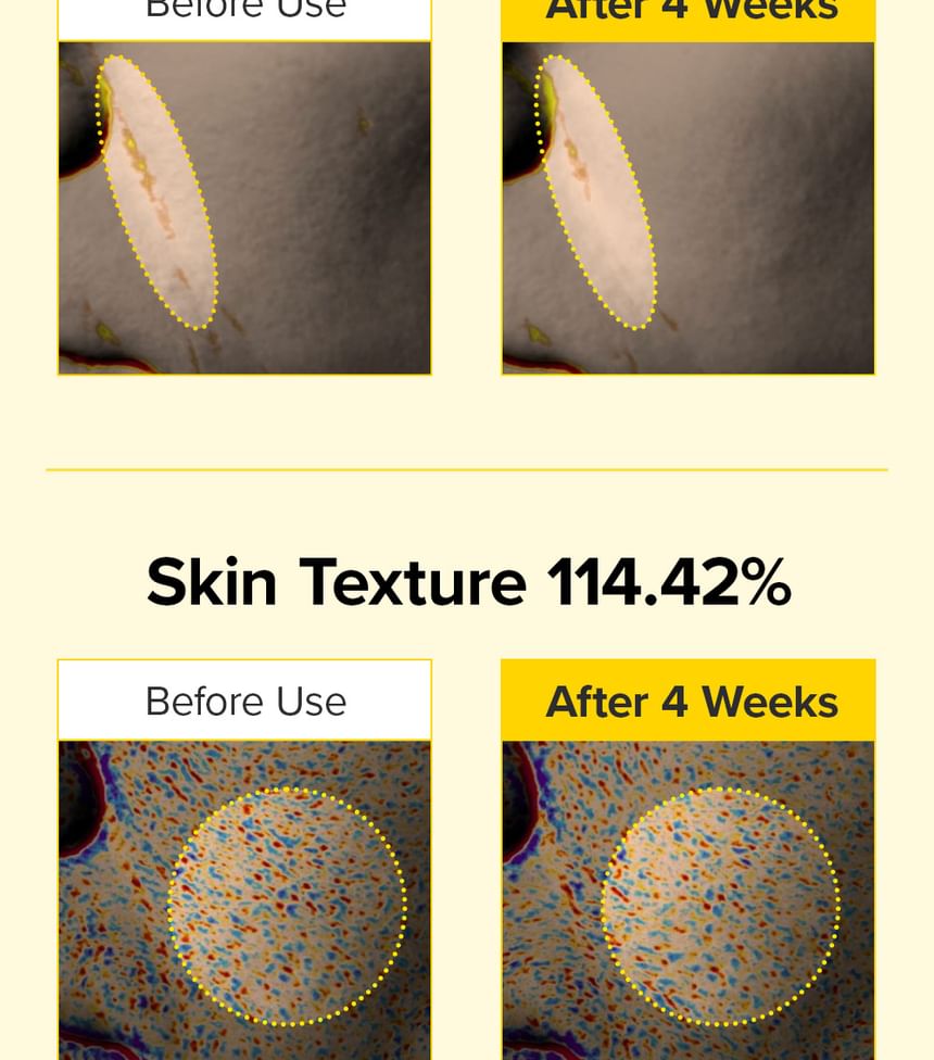 Mary&May - Spicule Retinol PDRN Cream 15g - Gallery 12