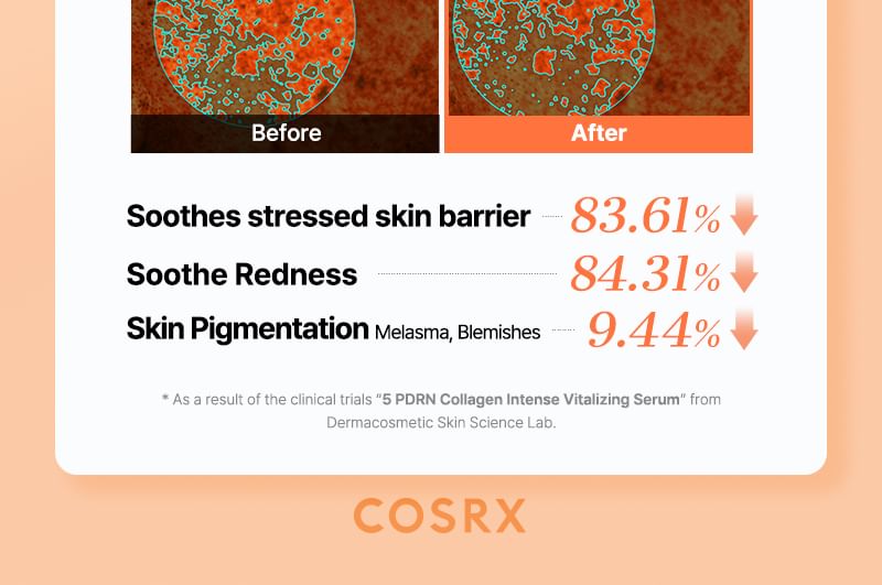 COSRX - 5 PDRN Collagen Intense Vitalizing Serum 100ml - Gallery 18