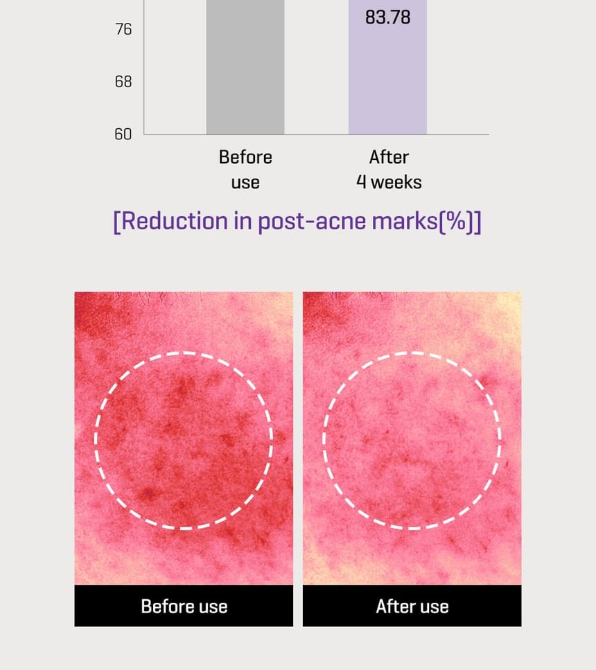 SOME BY MI - Retinol Bakuchiol Bubble Toner 100ml - Gallery 19