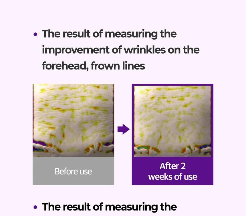 SOME BY MI - Retinol Intense Advanced Triple Action Eye Cream - Gallery 13