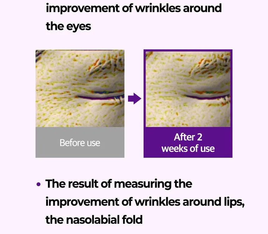 SOME BY MI - Retinol Intense Advanced Triple Action Eye Cream - Gallery 14