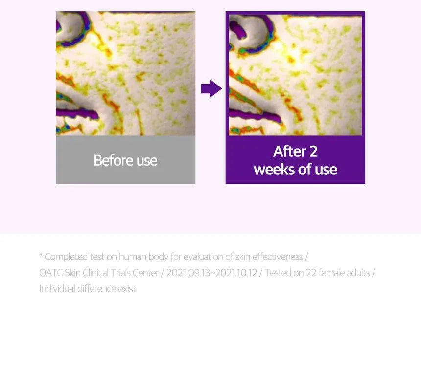 SOME BY MI - Retinol Intense Advanced Triple Action Eye Cream - Gallery 15