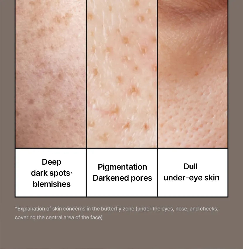 celimax - Pore+Dark Spot Brightening Cream - Gallery 17