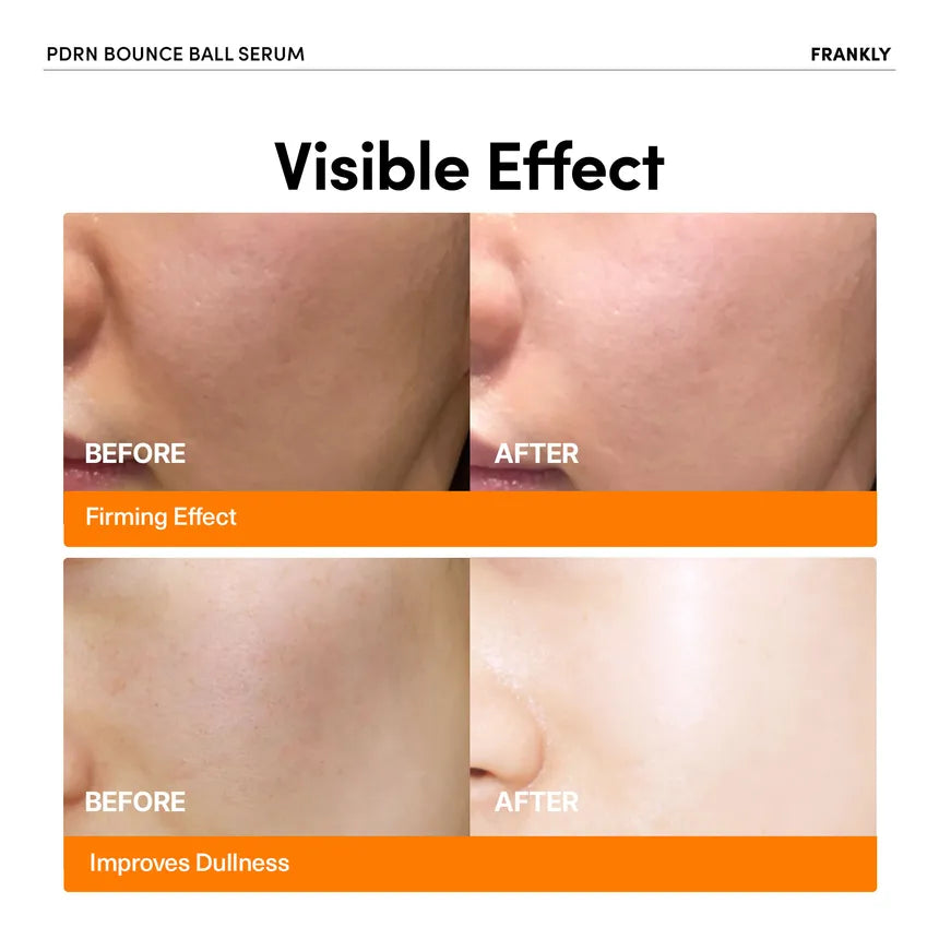 FRANKLY - PDRN Bounce Ball Serum 30ml - Gallery 1
