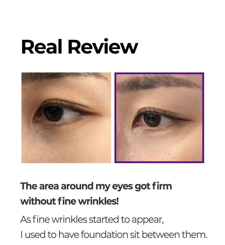 SOME BY MI - Retinol Intense Advanced Triple Action Eye Cream - Gallery 16