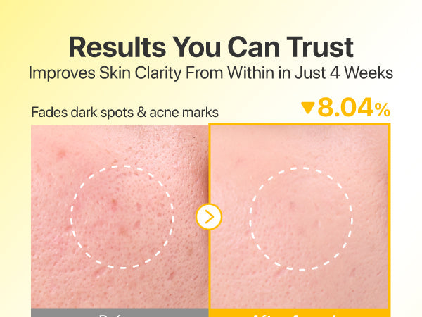 numbuzin - No.5+ Glutathione Vitamin-Concentrated Toner Pads - Gallery 3