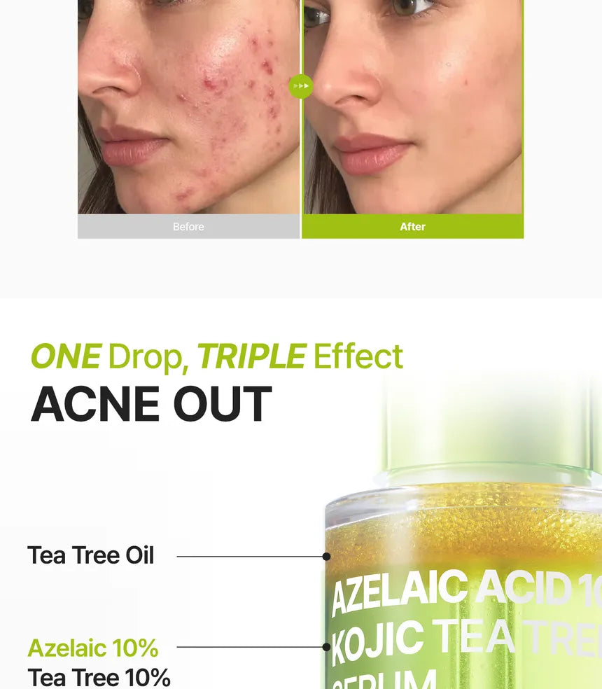 Purito SEOUL - Azelaic Acid 10 Kojic Tea Tree Serum 30ml - Gallery 2