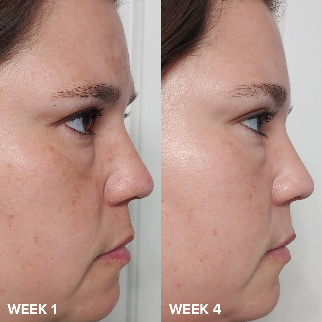 PAULA’S CHOISE BHA Liquid Exfoliant