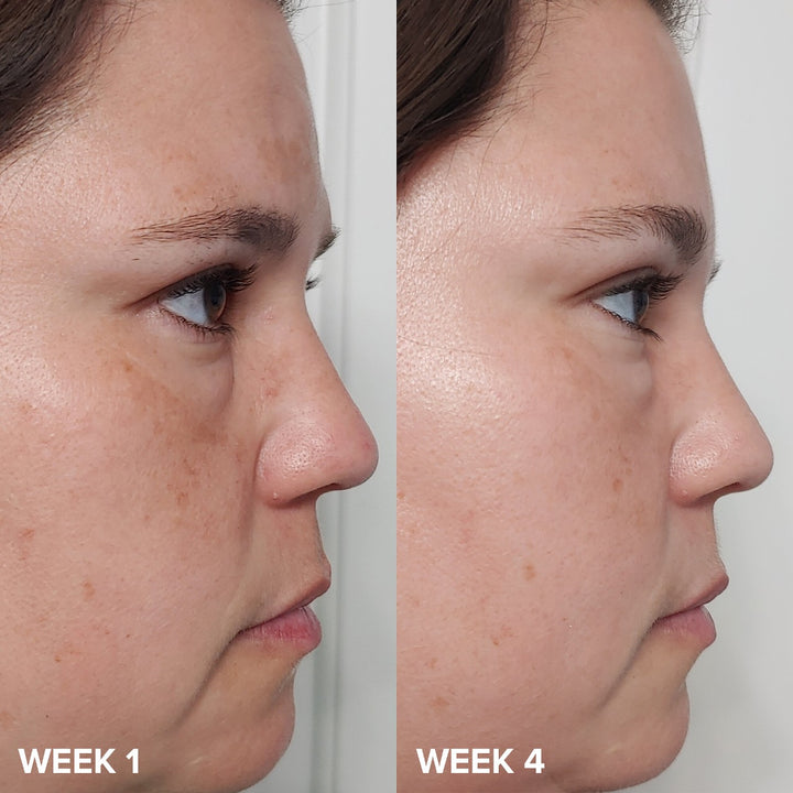 PAULA’S CHOISE BHA Liquid Exfoliant