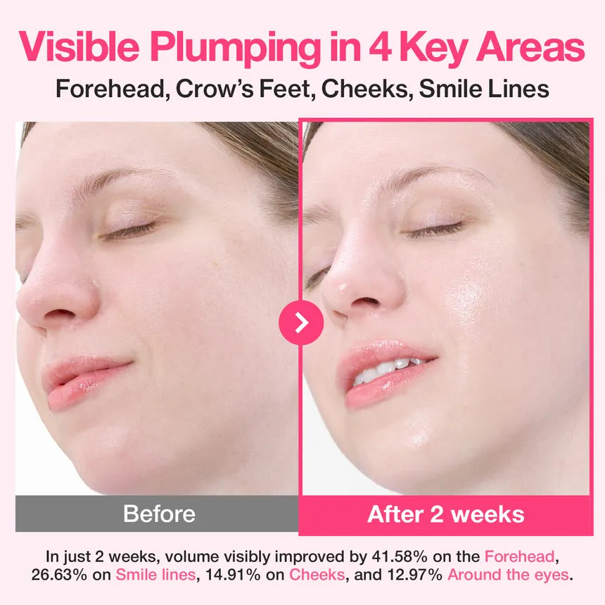 numbuzin - No.2 Rose PDRN Collagen Plumping Serum - Gallery 2