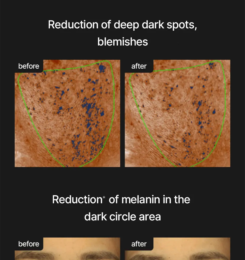 celimax - Pore+Dark Spot Brightening Cream - Gallery 35