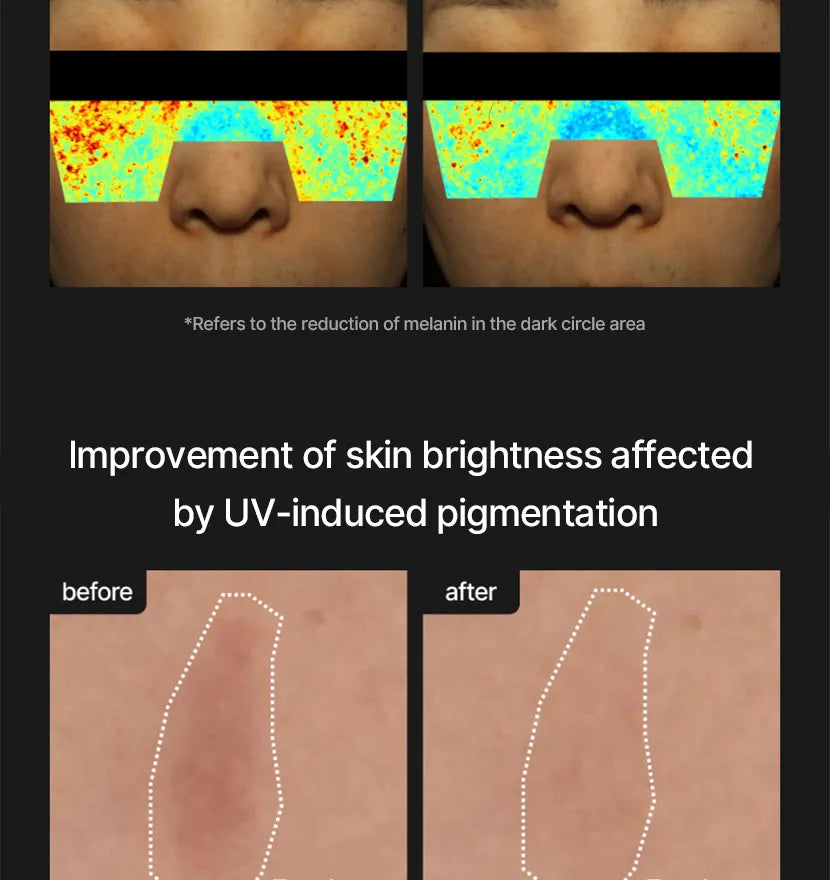 celimax - Pore+Dark Spot Brightening Cream - Gallery 36