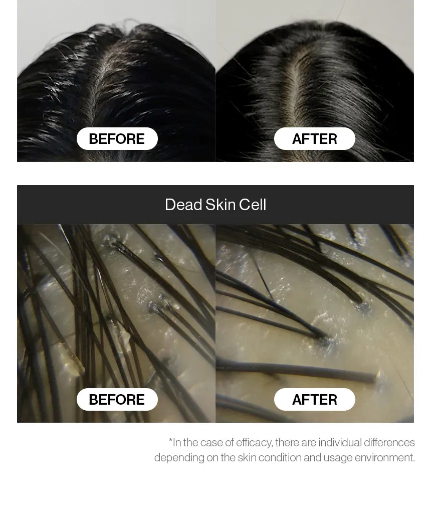 GROWUS - Sea Salt Therapy Scalp Scaler - Gallery 4