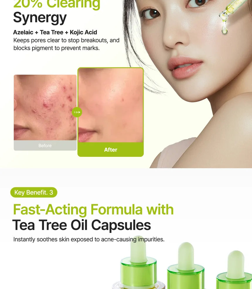 Purito SEOUL - Azelaic Acid 10 Kojic Tea Tree Serum 30ml - Gallery 4
