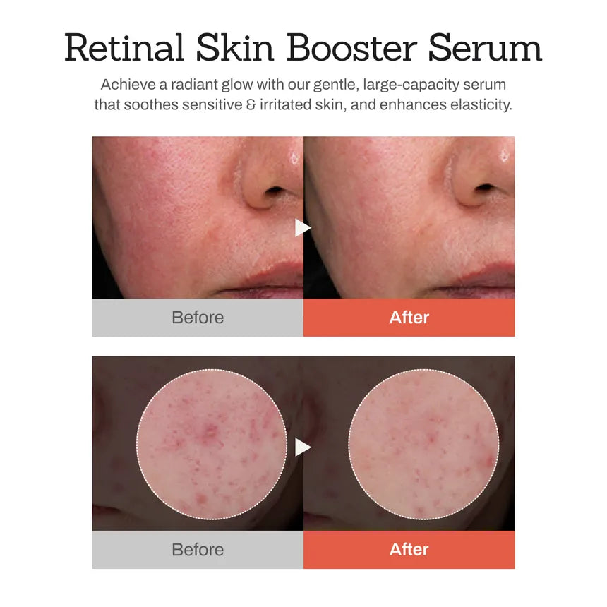 Meditherapy - Retinal Skin Booster Serum 150ml - Gallery 4