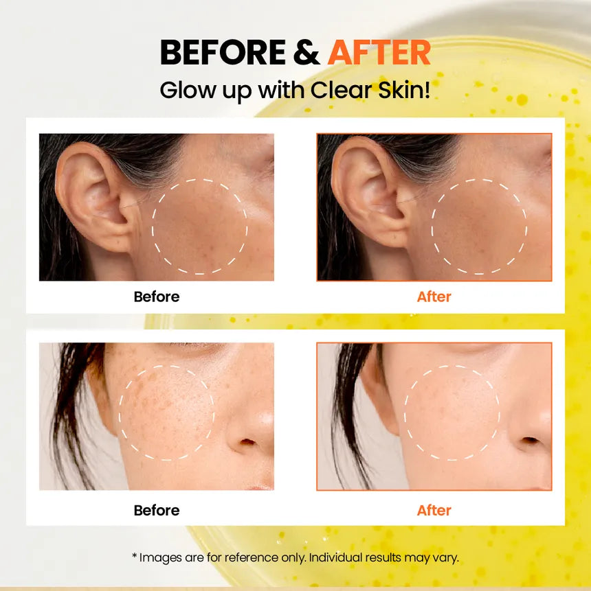 KSECRET - SEOUL 1988 Glow Serum : Niacinamide 15% + Yuja - Gallery 6