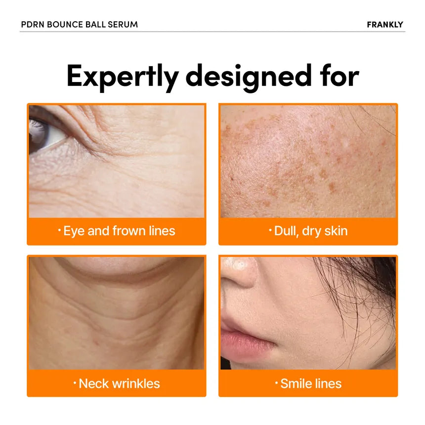 FRANKLY - PDRN Bounce Ball Serum 30ml - Gallery 6