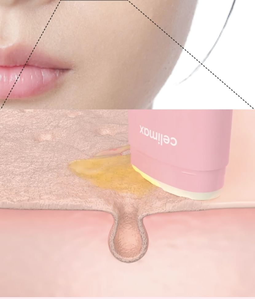 celimax - Oil Control Mattifying Sun Stick - Gallery 7