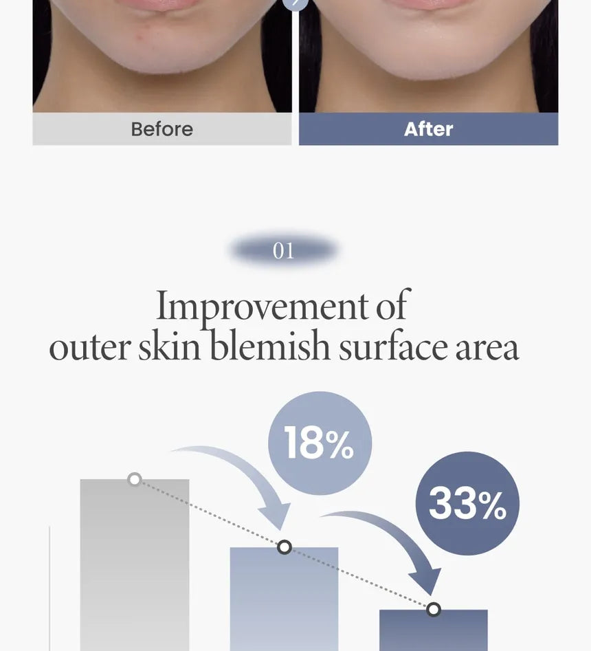 AXIS - Y - TXA 2.5% Intensive Brightening Cream - Gallery 8