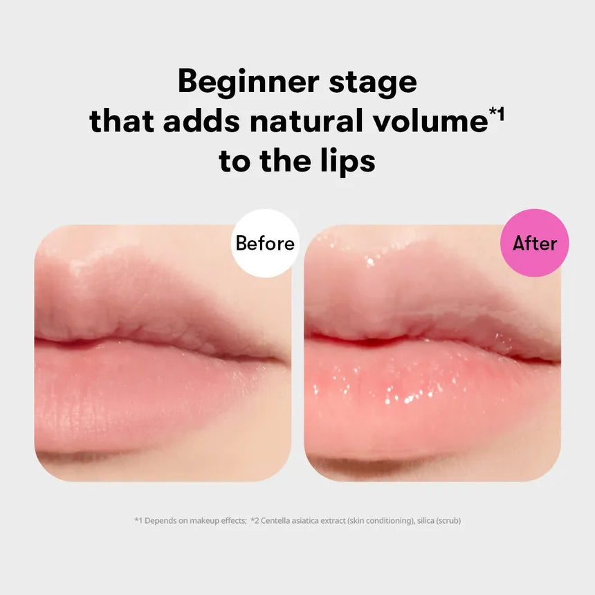 VT - Reedle Shot Lip Plumper Beginner - Gallery 9