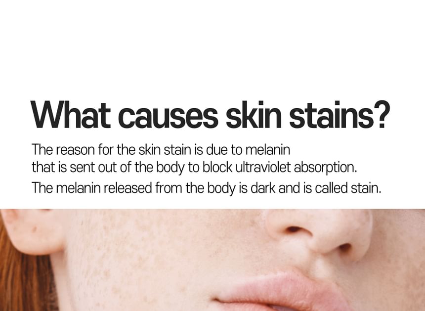 CARE:NEL - Anti-Melasma Cica Cream 40ml - Gallery 13