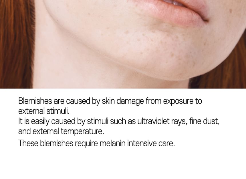 CARE:NEL - Anti-Melasma Cica Cream 40ml - Gallery 14
