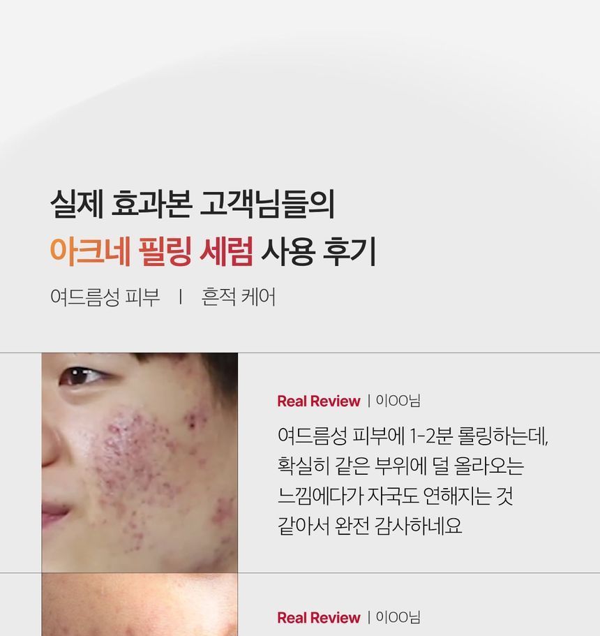 medicube - Red Acne Succinic Acid Peel - Gallery 2