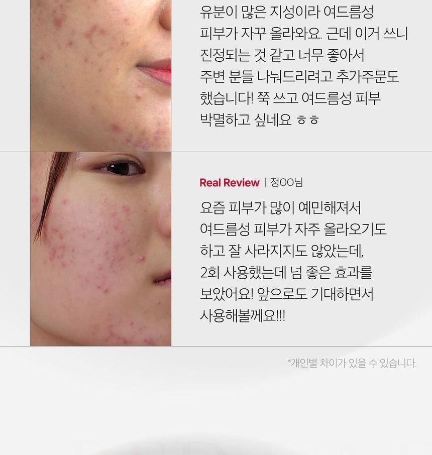 medicube - Red Acne Succinic Acid Peel - Gallery 1