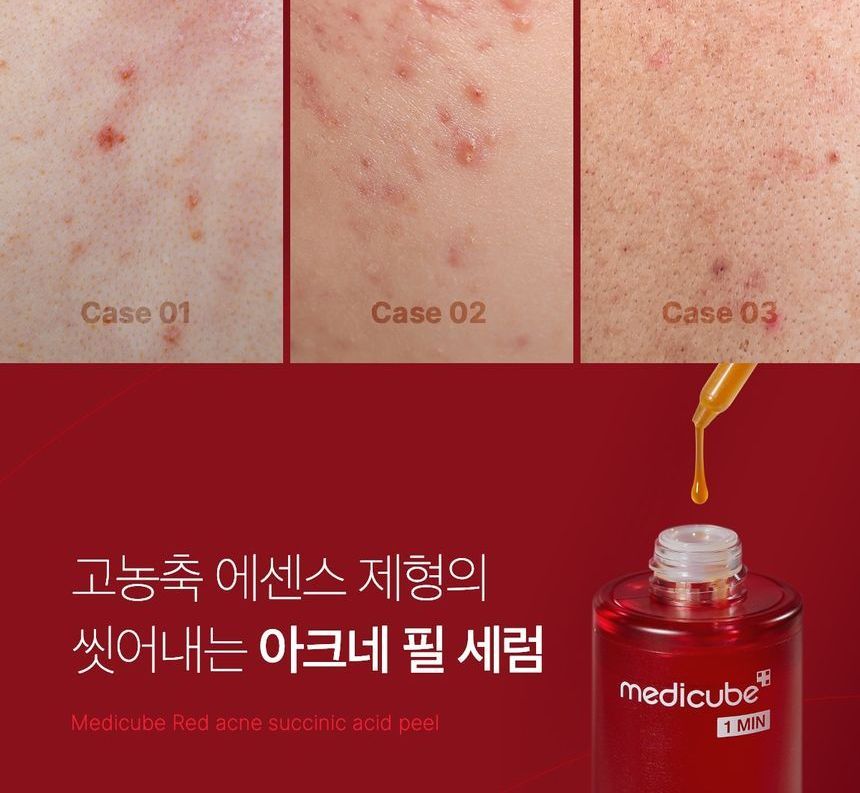 medicube - Red Acne Succinic Acid Peel - Gallery 4