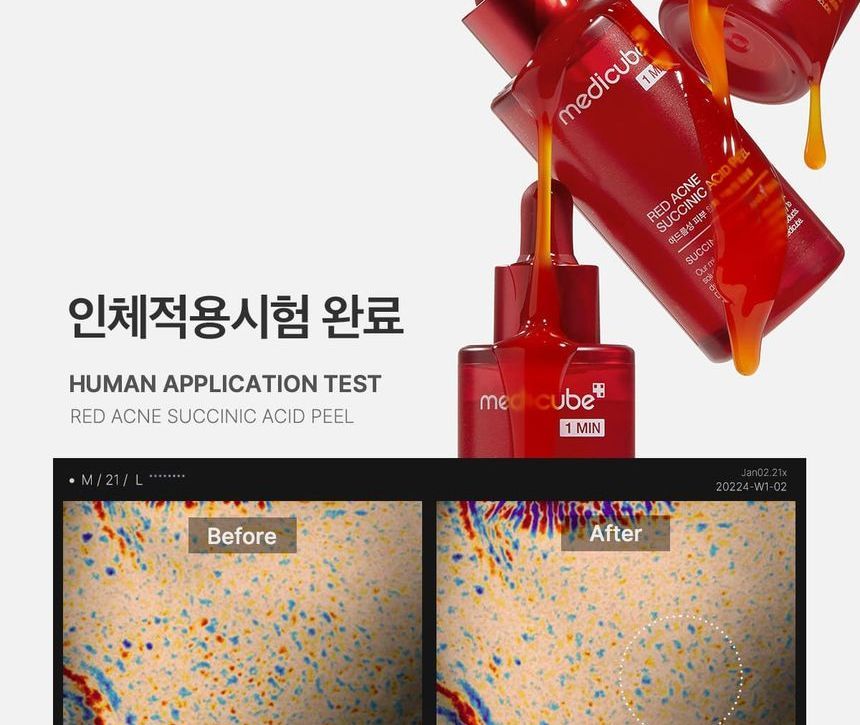 medicube - Red Acne Succinic Acid Peel - Gallery 12