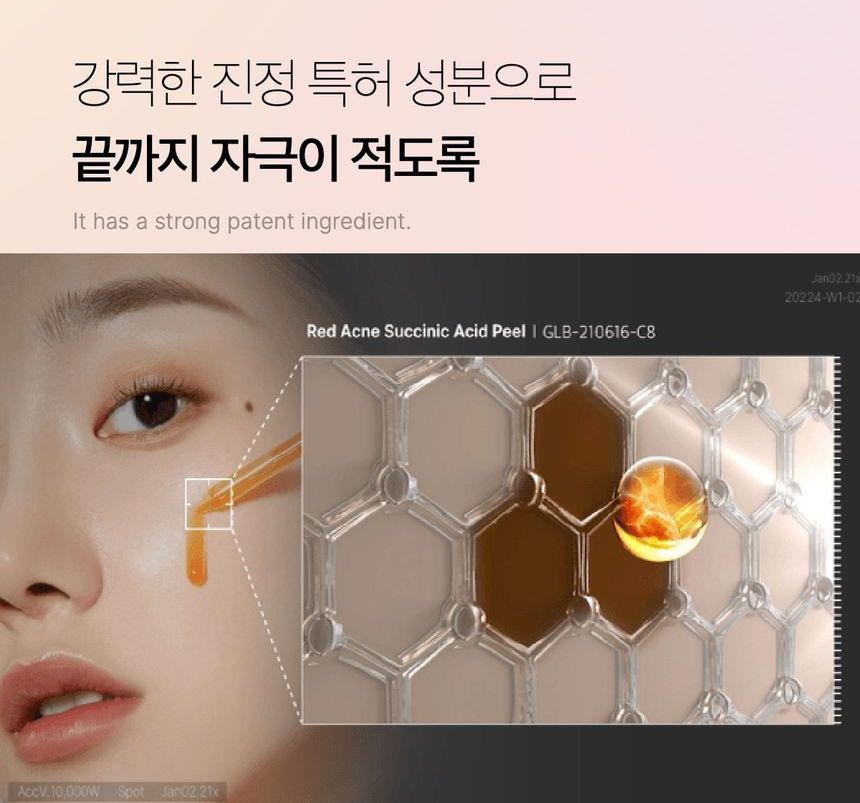 medicube - Red Acne Succinic Acid Peel - Gallery 35