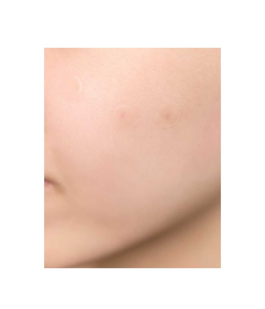 SKIN1004 - Spot Cover Patch - Gallery 4