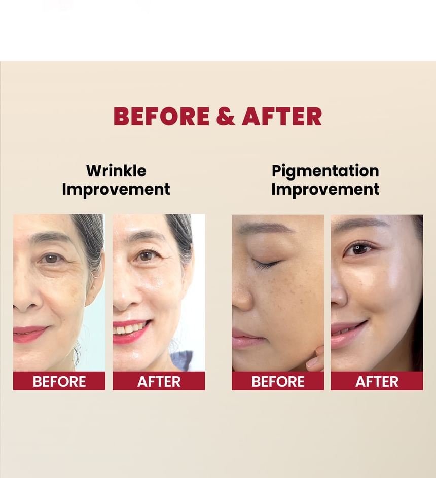 KSECRET - SEOUL 1988 Serum : Retinal Liposome 2% + Black Ginseng Bundle Set - Gallery 3
