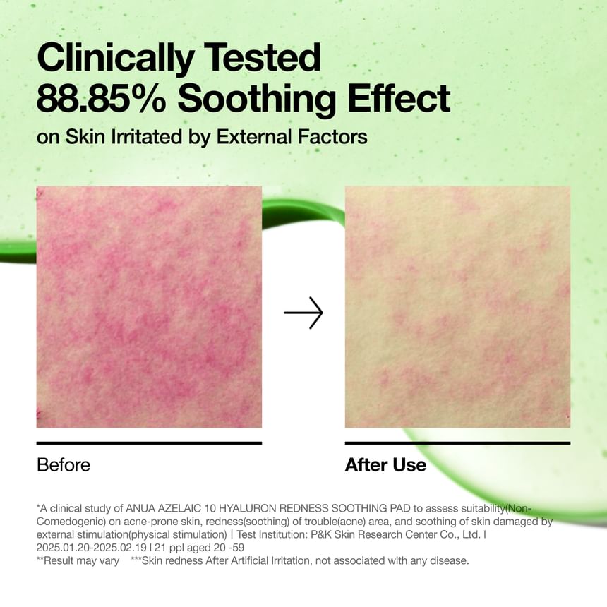 Anua - Azelaic 10 Hyaluron Redness Soothing Pad - Gallery 5