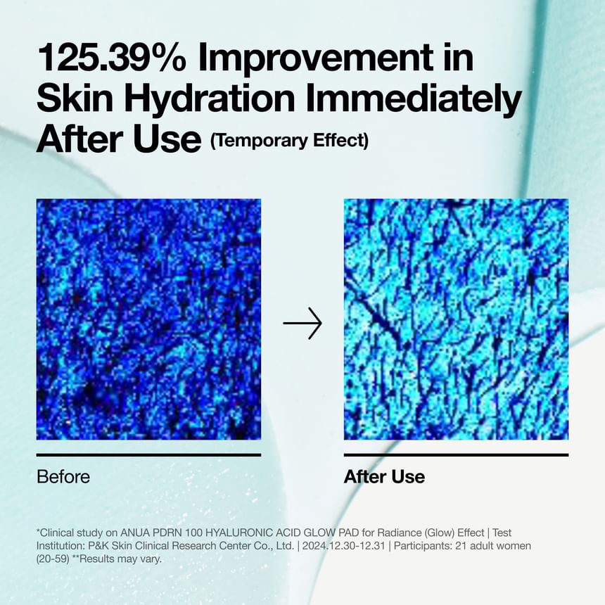 Anua - PDRN 100 Hyaluronic Acid Glow Pad - Gallery 5