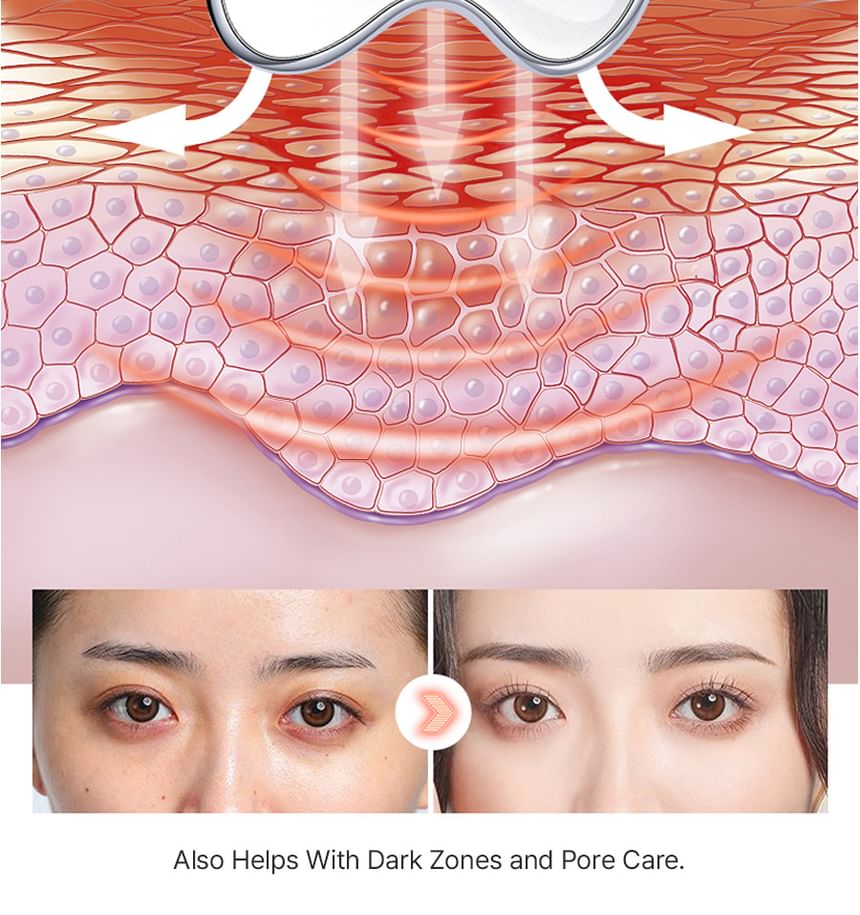 mommy care - Face Electric Care Massager - Gallery 14