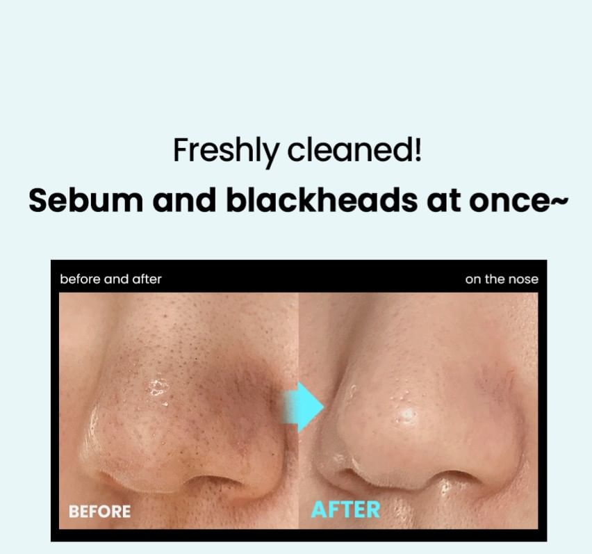 ilso - Super Melting Sebum Softener Special Set - Gallery 11