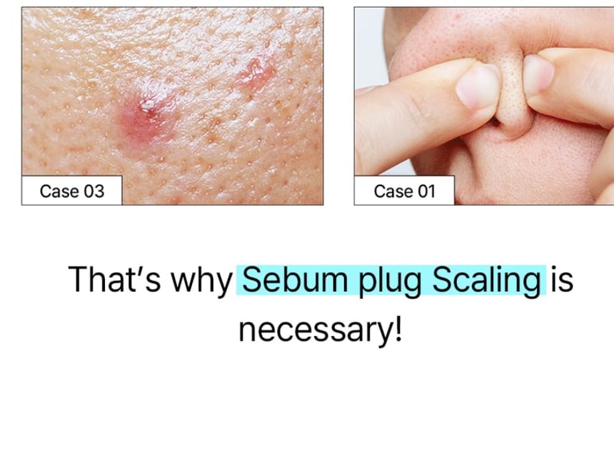ilso - Super Melting Sebum Softener Special Set - Gallery 16