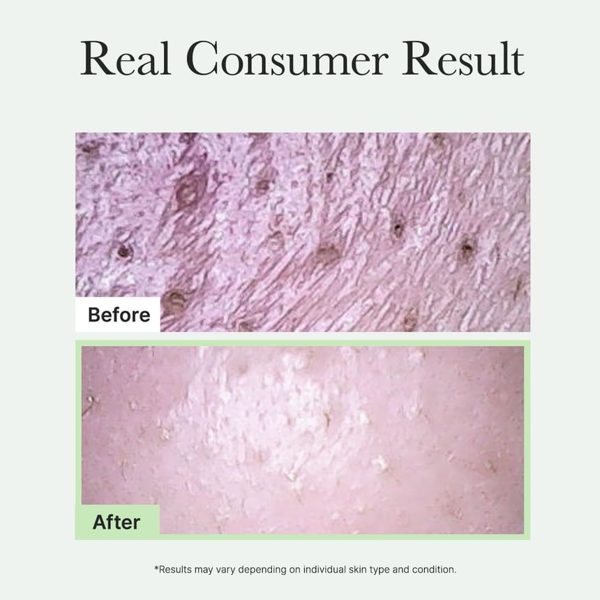 Arencia - Fresh Green Rice Mochi Cleanser - Gallery 6
